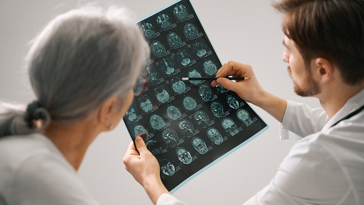 doctor holds brain scan to show senior woman