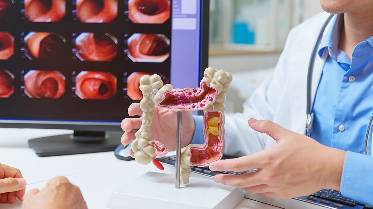 Doctor talking to patient with colonoscopy exam report on computer screen in background and colon model out on desk.