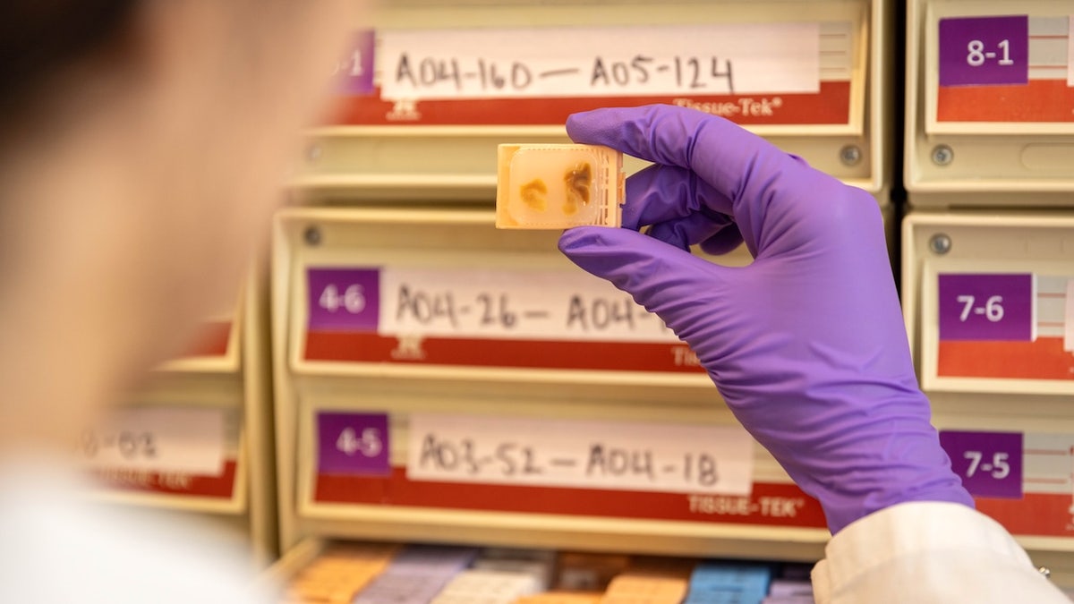 Man examines brain samples in lab