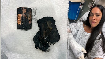 California woman hospitalized with chemical burns after portable charger explodes - Fox News