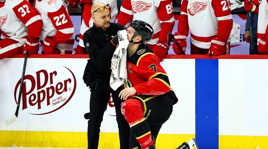 Matthew Tkachuk says Team USA hockey was ‘the most special team’ he’s ever been a part of