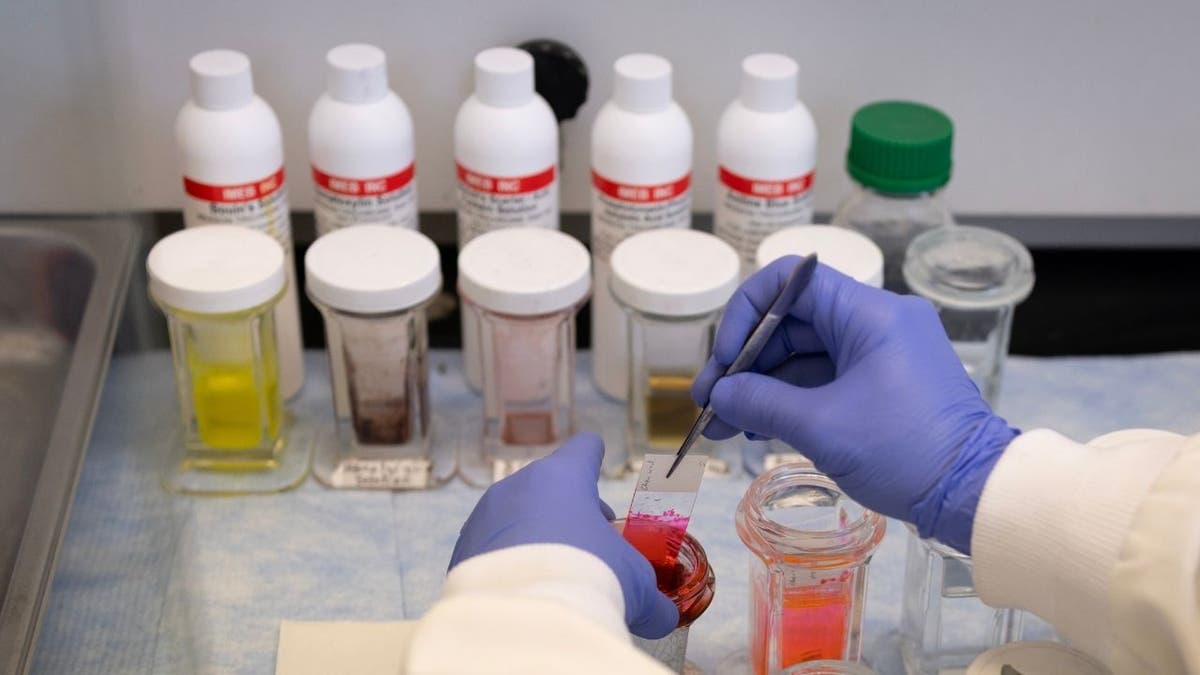 A researcher is seen conducting a test in a lab in the Department of Kinesiology and Nutrition at the University of Illinois Chicago on March 05, 2025 in Chicago, Illinois.