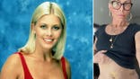 Nicole Eggert, seen on "Baywatch" in a red swimsuit and now, lifting her shirt and showing hysterectomy scars