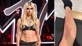 Taylor Momsen rushed to hospital after venomous spider bite during AC/DC tour - Fox News