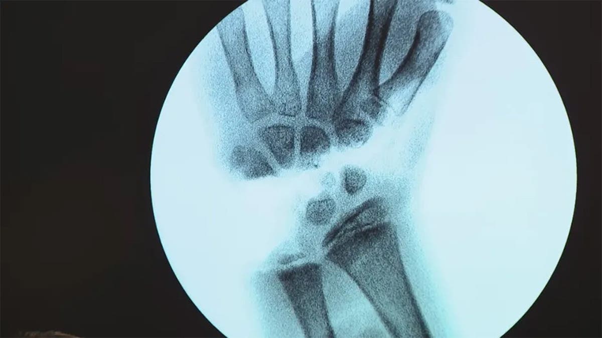 La radiografía de Leah Lendel