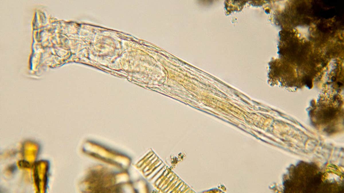 A close up microscopic image of rotifer