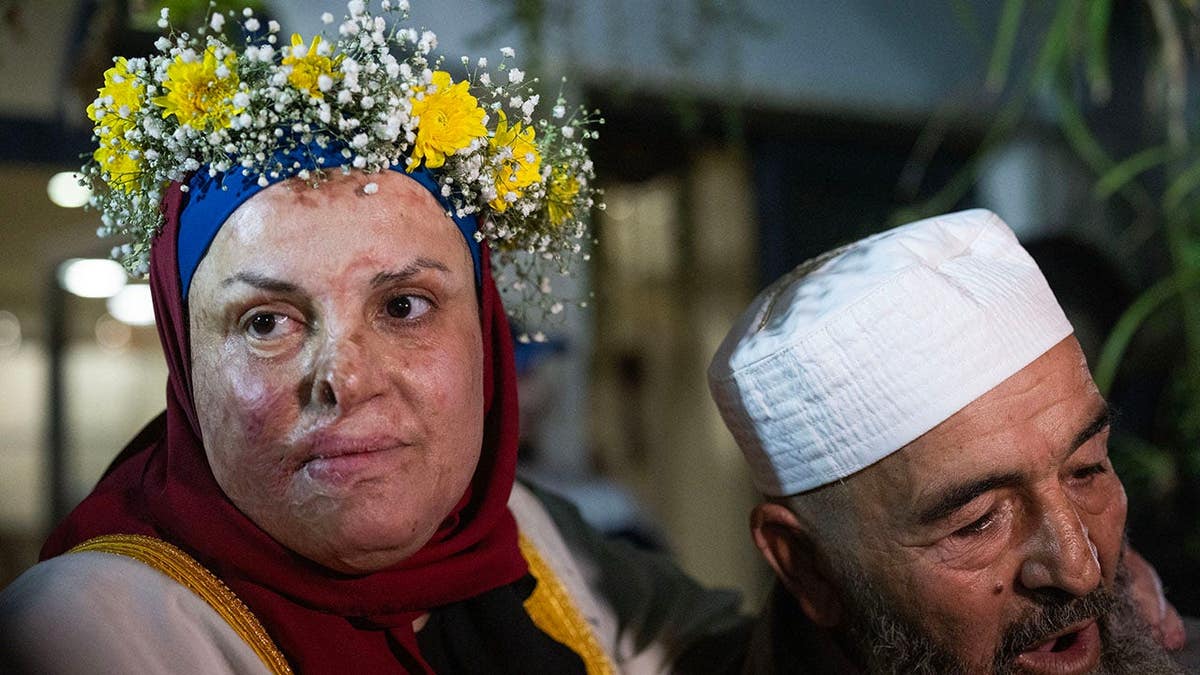 Palestinian prisoner Israa Jaabis arriving at her home in east Jerusalem