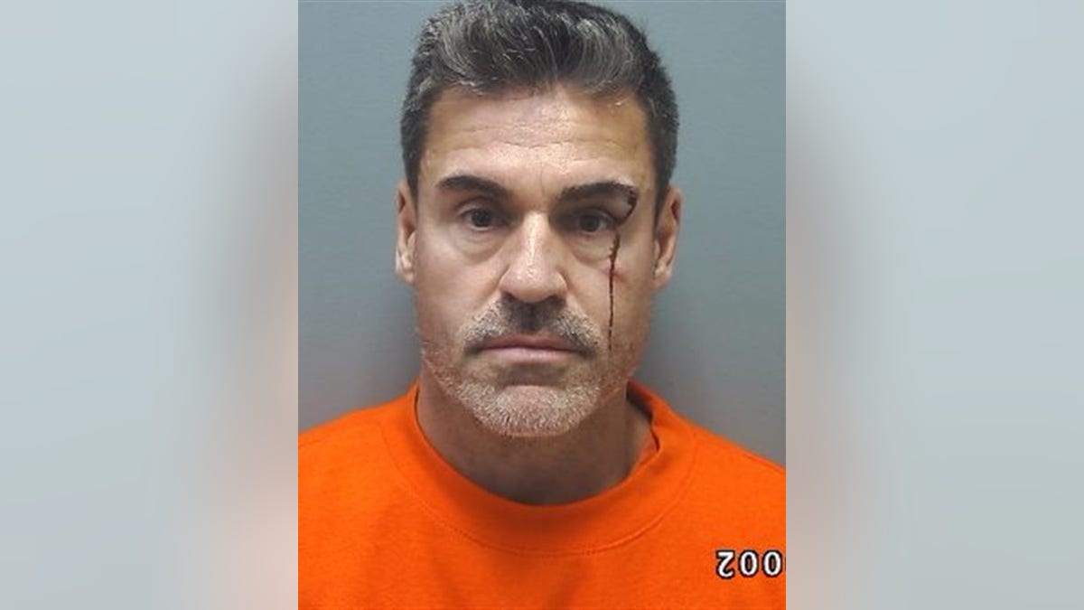 Mugshot of David Landsman wearing an orange shirt with a visible cut above his right eye and dried blood running down his cheek.