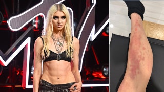 Taylor Momsen rushed to hospital after venomous spider bite during AC/DC tour