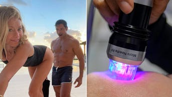 What is butt microneedling? Behind the 'desperate' procedure Kelly Ripa tried - Fox News