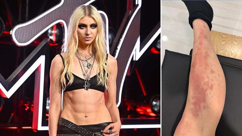 Taylor Momsen rushed to hospital after venomous spider bite during AC/DC tour