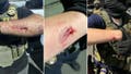 Anti-ICE agitator charged with allegedly biting officers during Delaney Hall clashes - Fox News