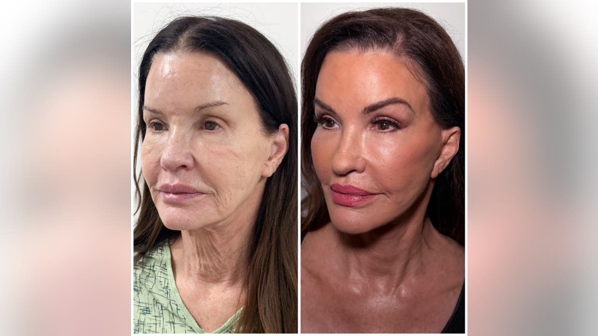 Janice Dickinson posa en unas fotos comparativas de perfil, una «antes» y otra «después», en la que en la imagen del «después» lleva maquillaje.