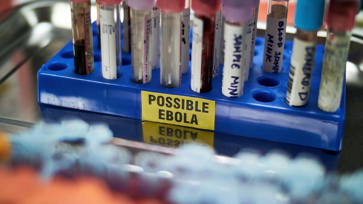 Blood sample vial labeled positive for Ebola virus