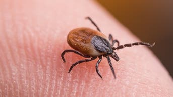 Tick bite ER visits hit highest seasonal level in years as doctors warn of disease surge - Fox News