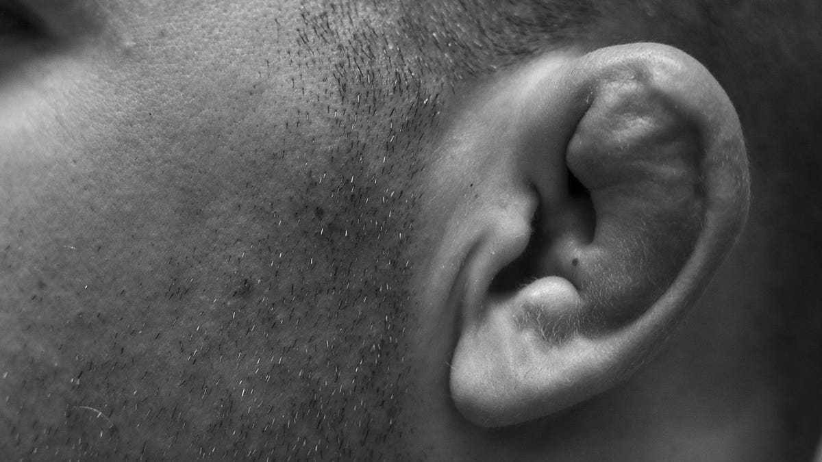 Cauliflower ear close-up