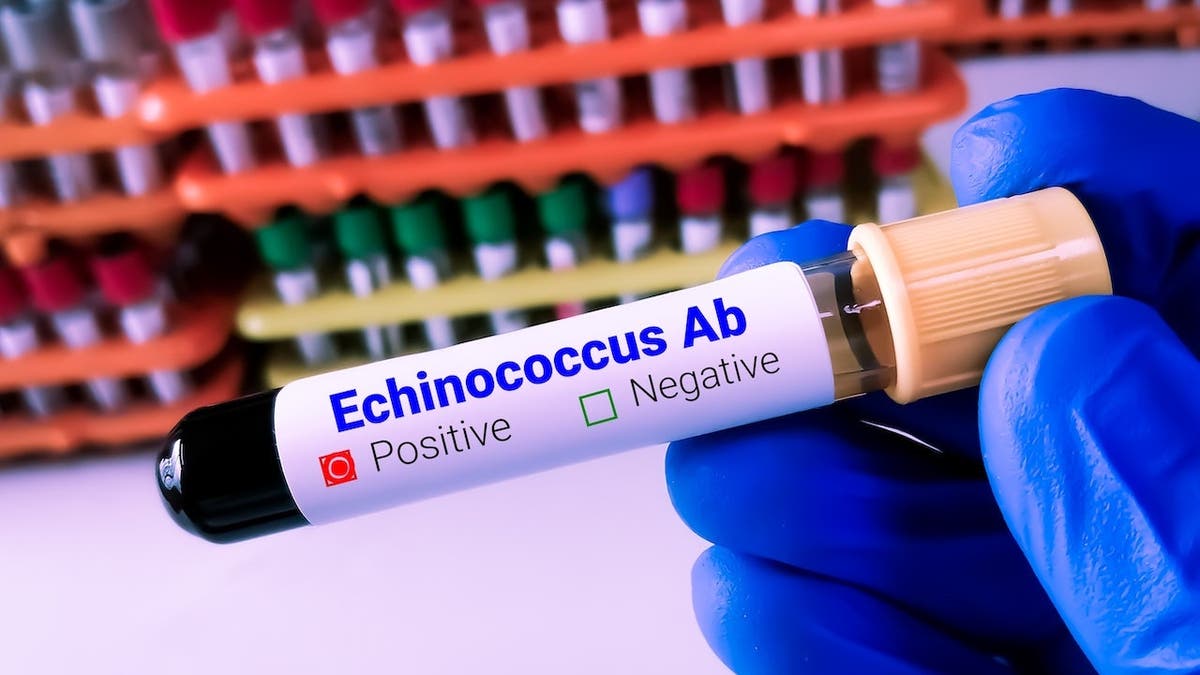 Scientist holding humor illustration for Echinococcus antibody test.