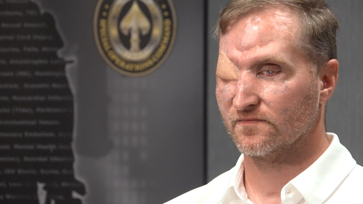 Maj. Jonathan Turnbull's injuries.