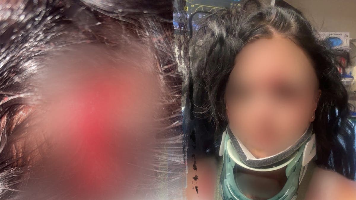 split image shows blurred head injury on left and blurred image of victim in neck brace on right