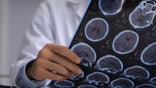 Doctor reading brain scans