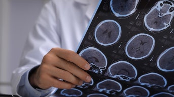 Los dolores de cabeza de un hombre hicieron que los médicos sospecharan que tenía cáncer, pero la verdadera causa era mucho más extraña - Fox News