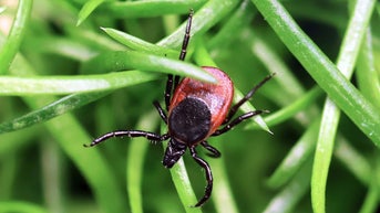 Se disparan los casos de un virus mortal transmitido por garrapatas en EE. UU., mientras los médicos advierten de que la infección se produce en cuestión de minutos - Fox News