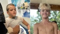 Microwaved squishy toy explodes onto boy's face and chest amid viral trend, causing horrific burns - Fox News