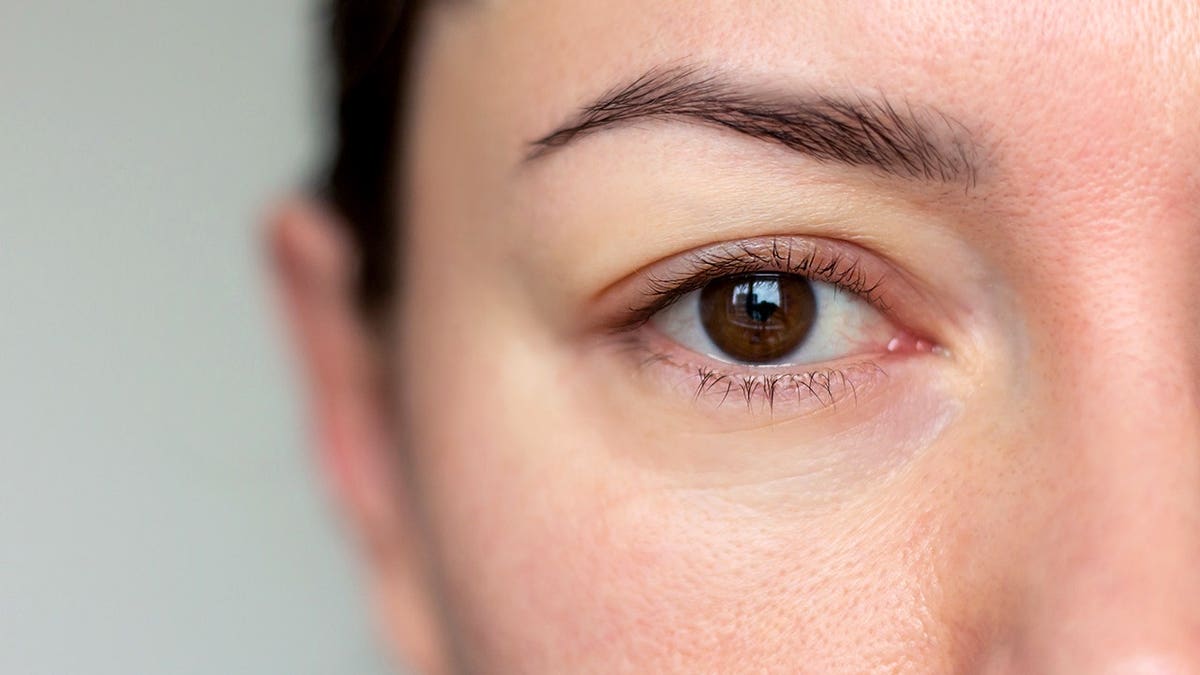 Young woman with a swollen face and eyes in a close-up shot.