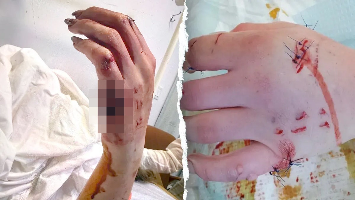 View of Claire Mcdonel 's injuries
