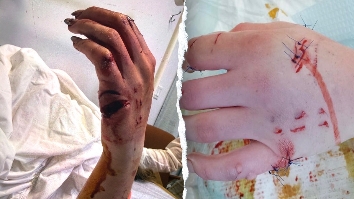 View of Claire's injuries