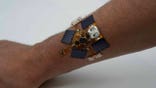Photo of a wearable patch on a person's forearm.