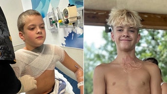 Teen says 'I thought I was going to die' after viral trend goes horribly wrong - Fox News