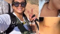 ‘Never give up a fight’: NYC mom shows her kids 5, 7 the scars from neck-slash attack as lesson in survival - Fox News