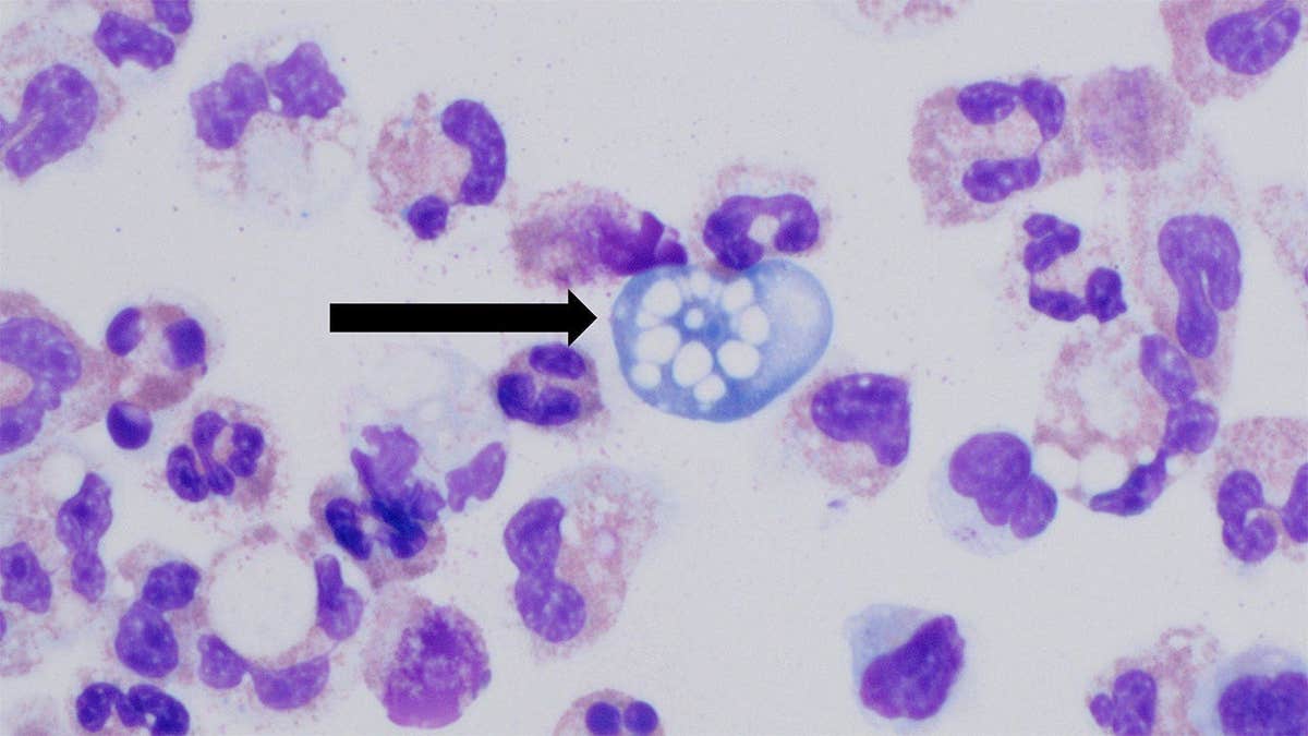 CDC microscopic image of Naegleria fowleri, the amoeba that can cause a rare brain infection