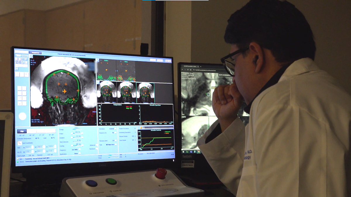 Doctor examines brain imaging scans