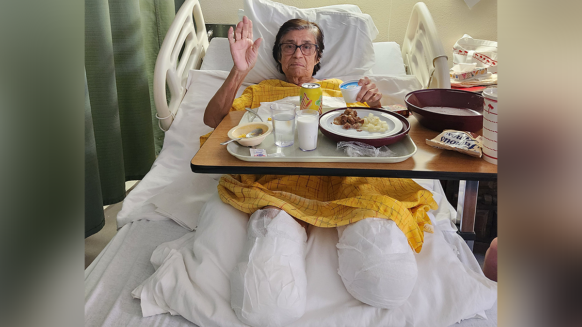 Cristina Vargas had to undergo amputations for both of her legs
