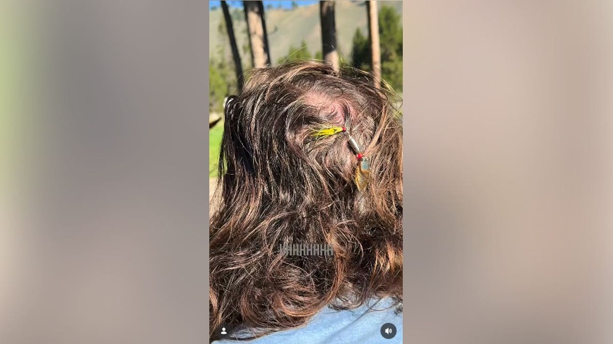 A fish hook stuck to the back of Tyler Hubbard's head.
