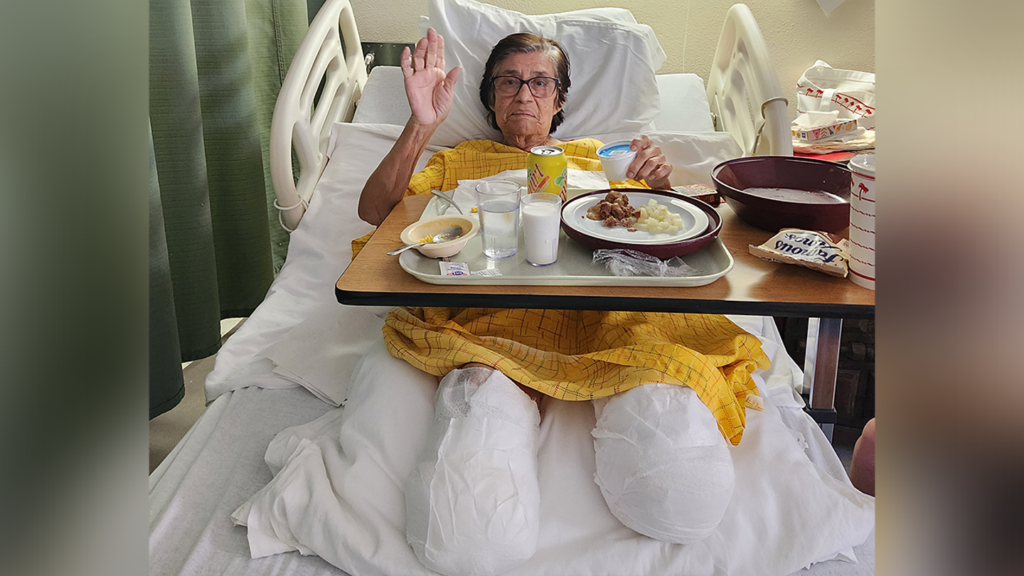 A una madre de California le amputan ambas piernas después de que un conductor sospechoso se estrellara contra la mesa del almuerzo de su restaurante.