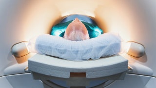 Major brain changes that occur around age 50 could impact dementia risk