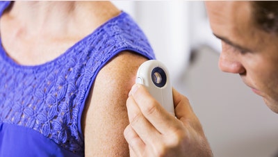 New immunotherapy shown to halt melanoma in study - Fox News