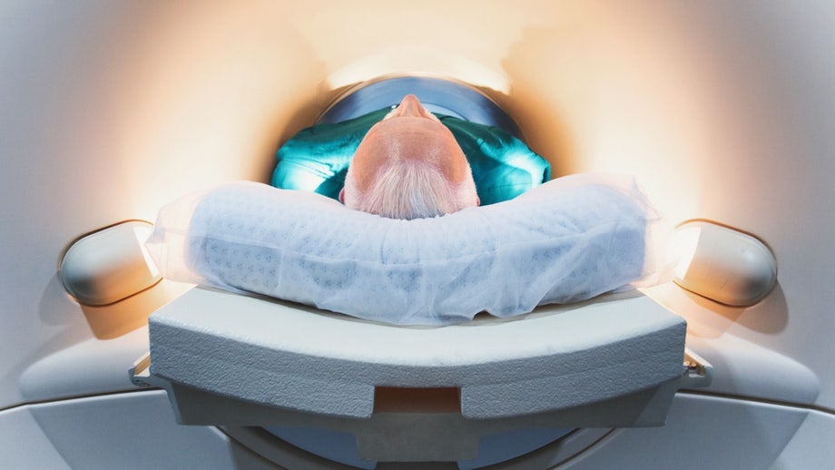 Major brain changes that occur around age 50 could impact dementia risk