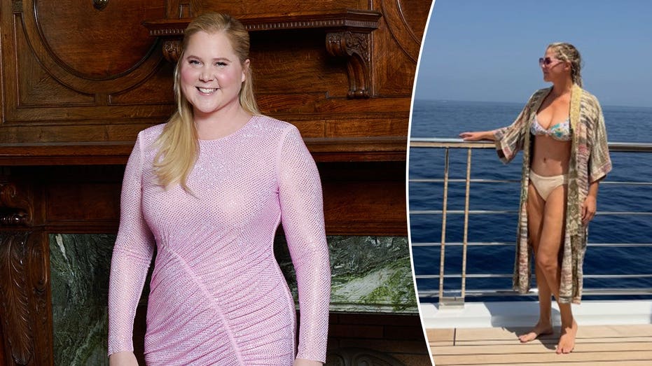 Amy Schumer earns praise for sharing unfiltered bikini photos amid her weight-loss journey