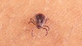 Scientists discover new tick-borne virus after testing thousands of patients with mysterious illnesses - Fox News