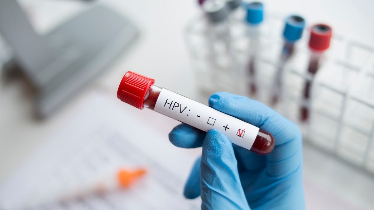 HPV blood test