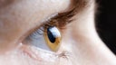 Popular weight-loss drugs face numerous lawsuits over rare ‘eye stroke’ linked to vision loss
