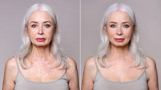 Celebrity plastic surgeon reveals when it's too soon for a facelift, and when waiting can backfire