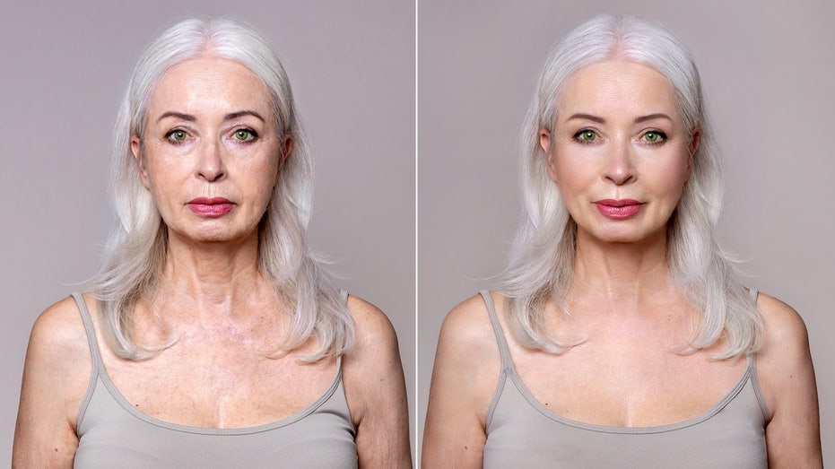 Celebrity plastic surgeon reveals when it's too soon for a facelift, and when waiting can backfire