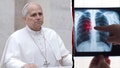 Pope Leo's lung tumor raises questions about cancer risk for nonsmokers - Fox News