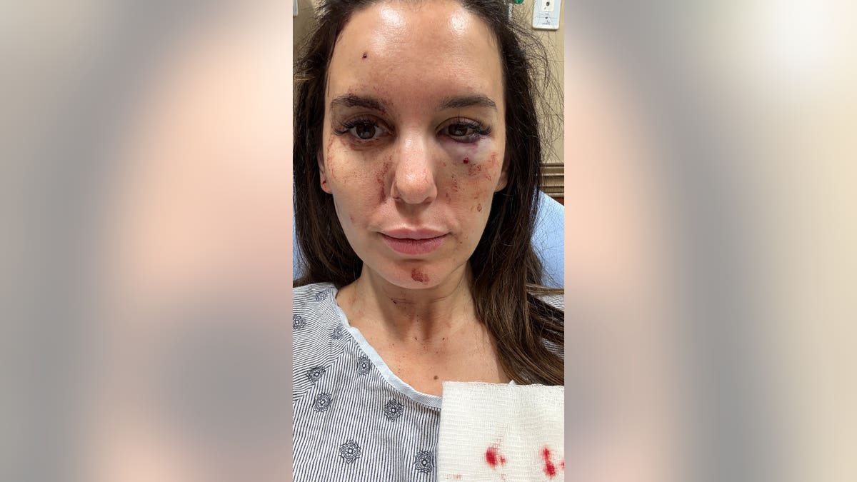 Selfie of Christy Carlson Romano showing her injury at the hospital.