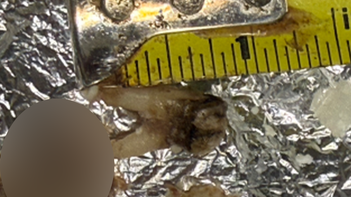 Cow tooth from Torchy's Tacos meal beside measuring tape